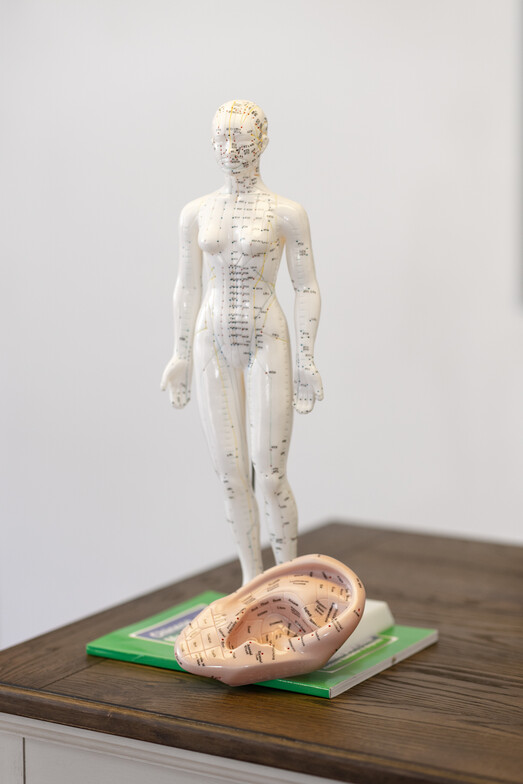 acupuncture, pain relief, needle, dry needling, alternative pain relief, natural pain relief, hormones, stress relief, 