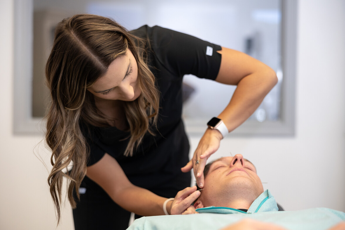 Acupuncture treatment for TMJ pain and muscle tension