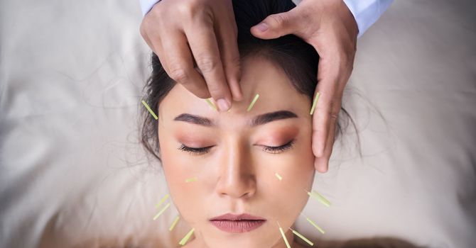 Acupuncture for Fertility and a Healthy Pregnancy