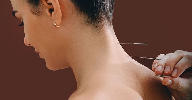 Acupuncture for Fertility and a Healthy Pregnancy